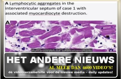 Dr. John Campbell: foto’s van myocarditis besproken – Nederlands ondertiteld